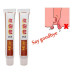 Hemorrhoids Ointment 100% Original Herbal Cream Hemorrhoids Ointment 100% Original Herbal Cream