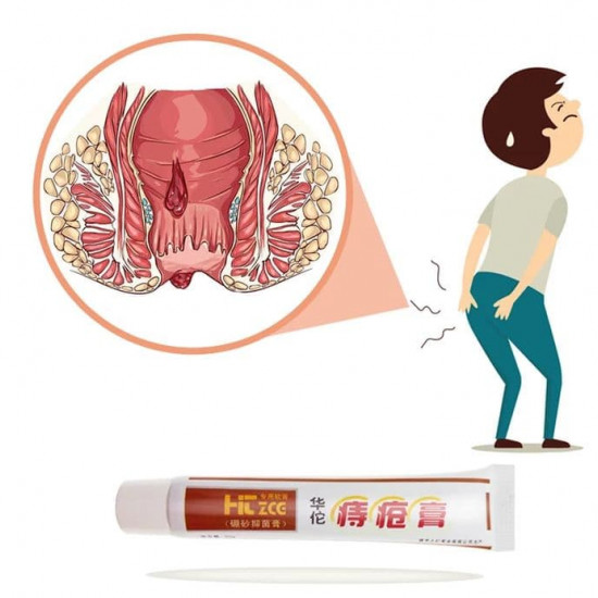 Hemorrhoids Ointment 100% Original Herbal Cream Hemorrhoids Ointment 100% Original Herbal Cream