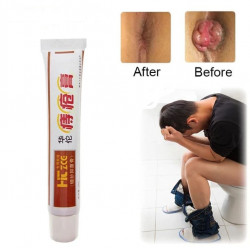 Hemorrhoids Ointment 100% Original Herbal Cream