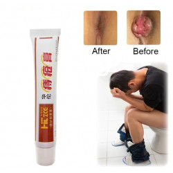 Hemorrhoids Ointment 100% Original Herbal Cream