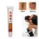 Hemorrhoids Ointment 100% Original Herbal Cream Hemorrhoids Ointment 100% Original Herbal Cream
