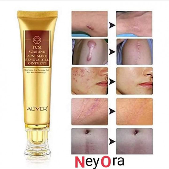 ALIVER TCM SCAR & ACEN MARK REMOVEL GEL OINTMENT ALIVER TCM SCAR & ACEN MARK REMOVEL GEL OINTMENT