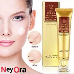 ALIVER TCM SCAR & ACEN MARK REMOVEL GEL OINTMENT