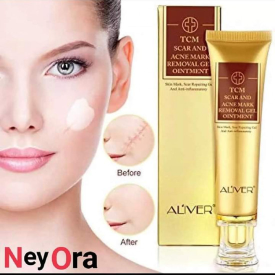 ALIVER TCM SCAR & ACEN MARK REMOVEL GEL OINTMENT ALIVER TCM SCAR & ACEN MARK REMOVEL GEL OINTMENT