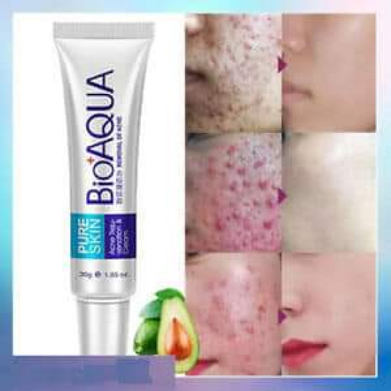 NEYORA BIOAQUA PURE SKIN CREAM NEYORA BIOAQUA PURE SKIN CREAM