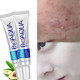 NEYORA BIOAQUA PURE SKIN CREAM NEYORA BIOAQUA PURE SKIN CREAM