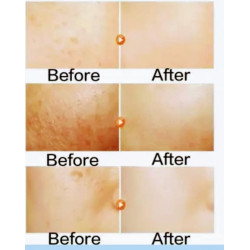 ALPHA WHITENING FACE CREAM AND BODY LOTION