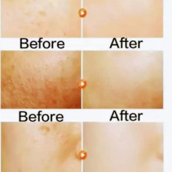 ALPHA WHITENING FACE CREAM AND BODY LOTION