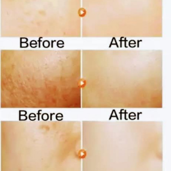 ALPHA WHITENING FACE CREAM AND BODY LOTION