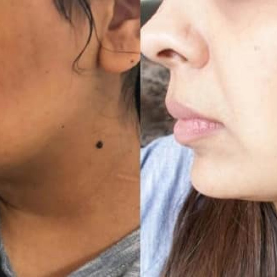 ALPHA WHITENING FACE CREAM AND BODY LOTION