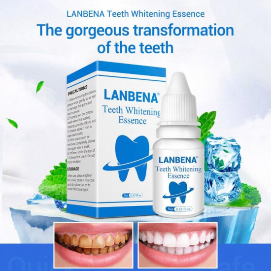 Teeth Whitening